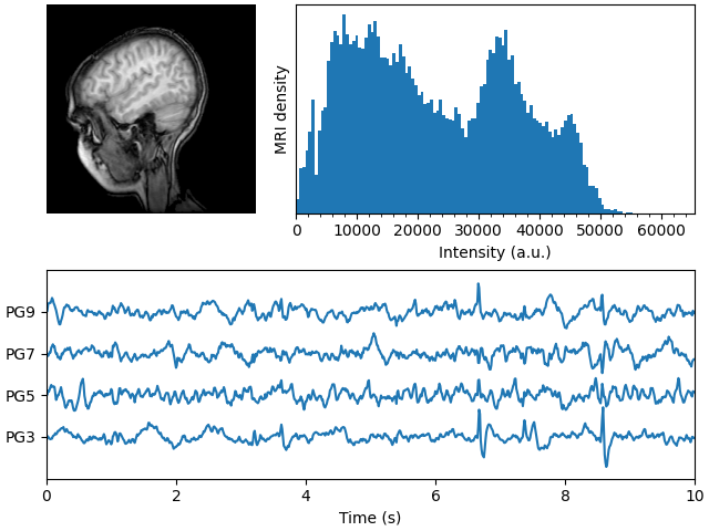 mri with eeg